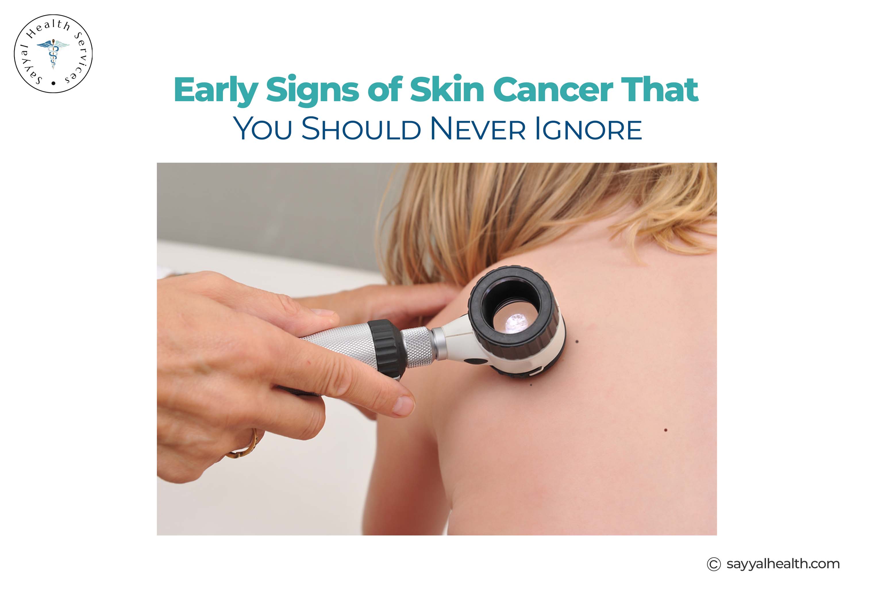 Early Signs of Skin cancer that you should never ignore